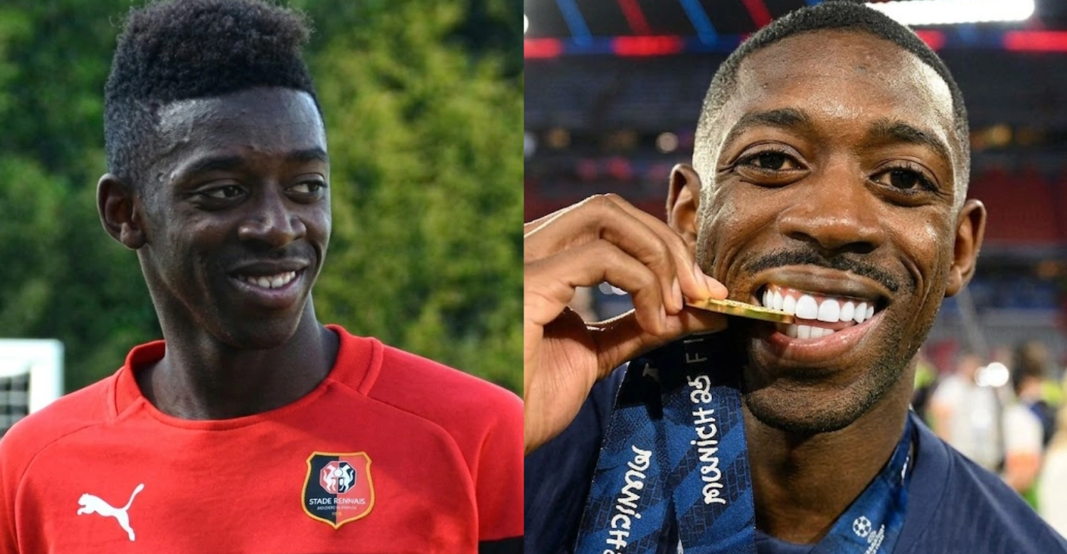 Ousmane Dembélé before and after